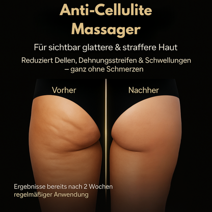 CelluLift® - Die Cellulite-Innovation