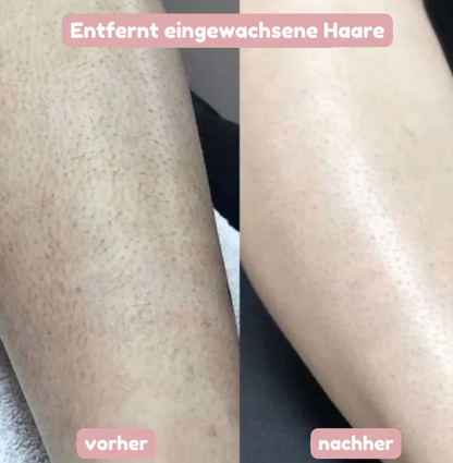 BloomShave® - 2-in-1 Damen Körperrasierer