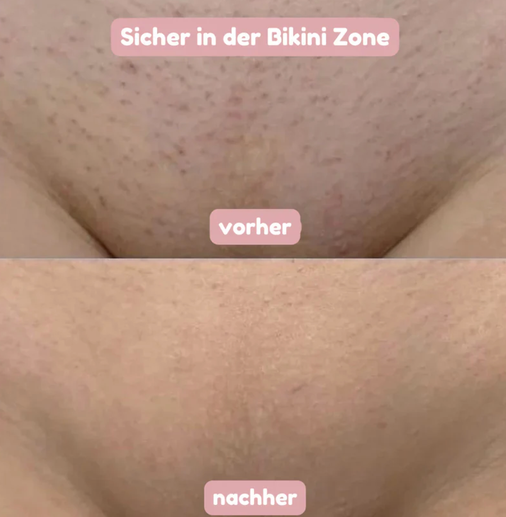 BloomShave® - 2-in-1 Damen Körperrasierer