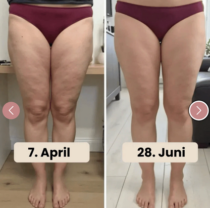 CelluFit® - Anti-Cellulite Leggins