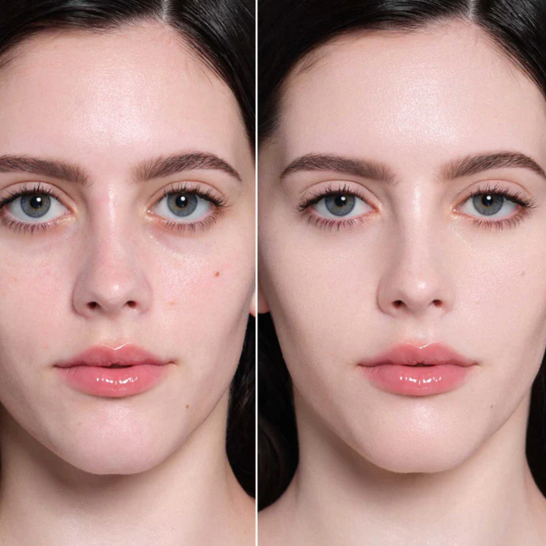 Strahlende Haut für ein neues Selbstbewusstsein